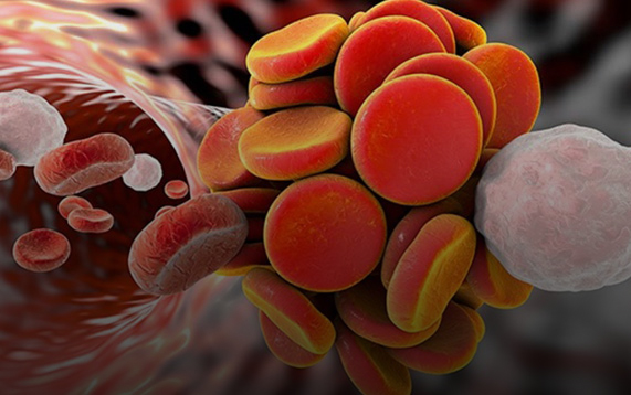 Le traitement anticoagulant est associé à une baisse de la mortalité